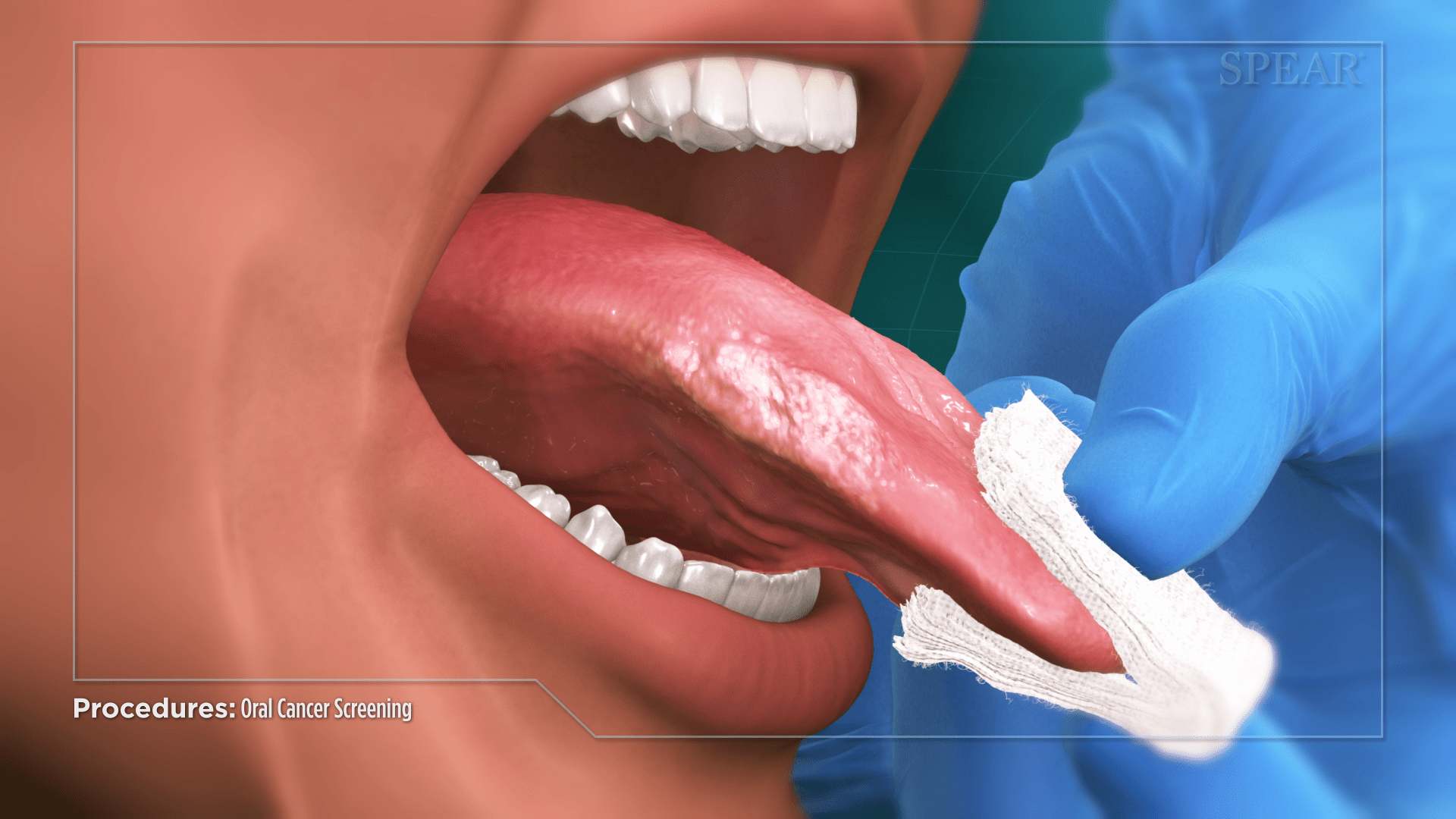 Tongue Inspection at SmileMore Dental